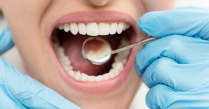 Preventive Dentistry 4
